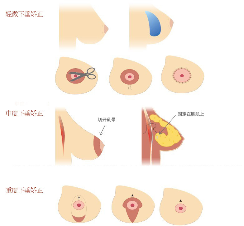 焦耳气体自由膨胀实验_乳腺膨胀实验游戏_时间膨胀实验
