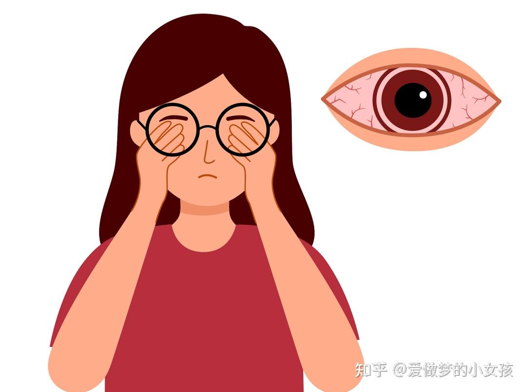眼睛一打游戏就疼_手机打游戏眼睛痛_打游戏眼睛疼用什么眼药水